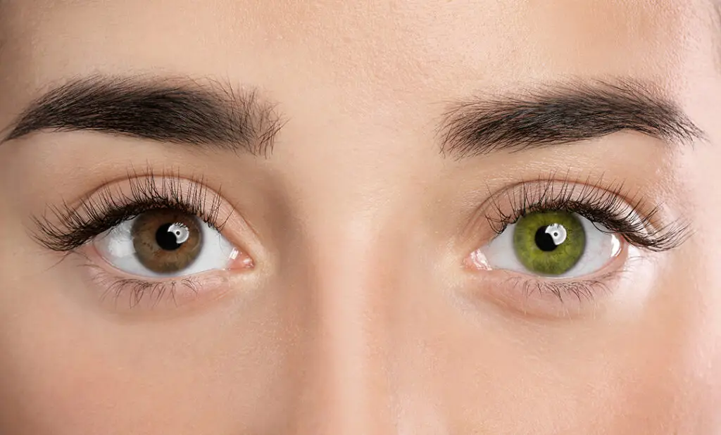 Vision Correction Change Eye Color